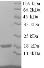 (Tris-Glycine gel) Discontinuous SDS-PAGE (reduced) with 5% enrichment gel and 15% separation gel. (Tris-Glycine gel) Discontinuous SDS-PAGE (reduced) with 5% enrichment gel and 15% separation gel.