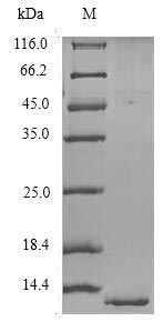 (Tris-Glycine gel) Discontinuous SDS-PAGE (reduced) with 5% enrichment gel and 15% separation gel. (Tris-Glycine gel) Discontinuous SDS-PAGE (reduced) with 5% enrichment gel and 15% separation gel.