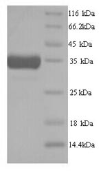 (Tris-Glycine gel) Discontinuous SDS-PAGE (reduced) with 5% enrichment gel and 15% separation gel. (Tris-Glycine gel) Discontinuous SDS-PAGE (reduced) with 5% enrichment gel and 15% separation gel.