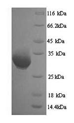(Tris-Glycine gel) Discontinuous SDS-PAGE (reduced) with 5% enrichment gel and 15% separation gel. (Tris-Glycine gel) Discontinuous SDS-PAGE (reduced) with 5% enrichment gel and 15% separation gel.