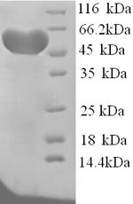 (Tris-Glycine gel) Discontinuous SDS-PAGE (reduced) with 5% enrichment gel and 15% separation gel. (Tris-Glycine gel) Discontinuous SDS-PAGE (reduced) with 5% enrichment gel and 15% separation gel.