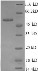 (Tris-Glycine gel) Discontinuous SDS-PAGE (reduced) with 5% enrichment gel and 15% separation gel. (Tris-Glycine gel) Discontinuous SDS-PAGE (reduced) with 5% enrichment gel and 15% separation gel.