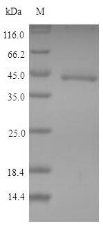 (Tris-Glycine gel) Discontinuous SDS-PAGE (reduced) with 5% enrichment gel and 15% separation gel. (Tris-Glycine gel) Discontinuous SDS-PAGE (reduced) with 5% enrichment gel and 15% separation gel.