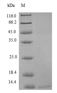 (Tris-Glycine gel) Discontinuous SDS-PAGE (reduced) with 5% enrichment gel and 15% separation gel. (Tris-Glycine gel) Discontinuous SDS-PAGE (reduced) with 5% enrichment gel and 15% separation gel.