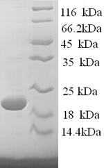 (Tris-Glycine gel) Discontinuous SDS-PAGE (reduced) with 5% enrichment gel and 15% separation gel. (Tris-Glycine gel) Discontinuous SDS-PAGE (reduced) with 5% enrichment gel and 15% separation gel.