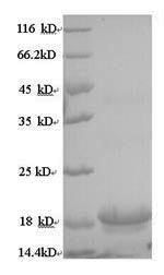 (Tris-Glycine gel) Discontinuous SDS-PAGE (reduced) with 5% enrichment gel and 15% separation gel. (Tris-Glycine gel) Discontinuous SDS-PAGE (reduced) with 5% enrichment gel and 15% separation gel.