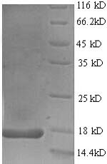 (Tris-Glycine gel) Discontinuous SDS-PAGE (reduced) with 5% enrichment gel and 15% separation gel. (Tris-Glycine gel) Discontinuous SDS-PAGE (reduced) with 5% enrichment gel and 15% separation gel.