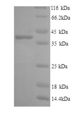 SDS-PAGE- Recombinant protein Human IL6R