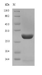 (Tris-Glycine gel) Discontinuous SDS-PAGE (reduced) with 5% enrichment gel and 15% separation gel. (Tris-Glycine gel) Discontinuous SDS-PAGE (reduced) with 5% enrichment gel and 15% separation gel.
