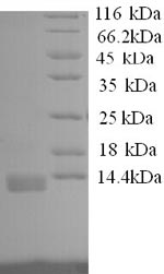 (Tris-Glycine gel) Discontinuous SDS-PAGE (reduced) with 5% enrichment gel and 15% separation gel. (Tris-Glycine gel) Discontinuous SDS-PAGE (reduced) with 5% enrichment gel and 15% separation gel.