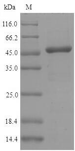 (Tris-Glycine gel) Discontinuous SDS-PAGE (reduced) with 5% enrichment gel and 15% separation gel. (Tris-Glycine gel) Discontinuous SDS-PAGE (reduced) with 5% enrichment gel and 15% separation gel.