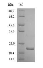 (Tris-Glycine gel) Discontinuous SDS-PAGE (reduced) with 5% enrichment gel and 15% separation gel. (Tris-Glycine gel) Discontinuous SDS-PAGE (reduced) with 5% enrichment gel and 15% separation gel.