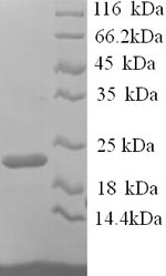 SDS-PAGE- Recombinant protein Mouse Itgal