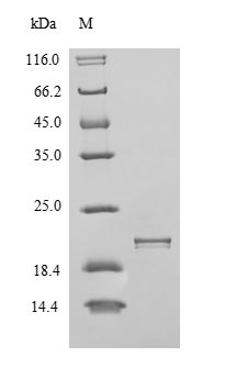 (Tris-Glycine gel) Discontinuous SDS-PAGE (reduced) with 5% enrichment gel and 15% separation gel. (Tris-Glycine gel) Discontinuous SDS-PAGE (reduced) with 5% enrichment gel and 15% separation gel.