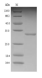 (Tris-Glycine gel) Discontinuous SDS-PAGE (reduced) with 5% enrichment gel and 15% separation gel. (Tris-Glycine gel) Discontinuous SDS-PAGE (reduced) with 5% enrichment gel and 15% separation gel.