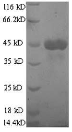 (Tris-Glycine gel) Discontinuous SDS-PAGE (reduced) with 5% enrichment gel and 15% separation gel. (Tris-Glycine gel) Discontinuous SDS-PAGE (reduced) with 5% enrichment gel and 15% separation gel.