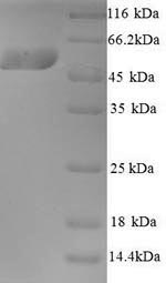 (Tris-Glycine gel) Discontinuous SDS-PAGE (reduced) with 5% enrichment gel and 15% separation gel. (Tris-Glycine gel) Discontinuous SDS-PAGE (reduced) with 5% enrichment gel and 15% separation gel.