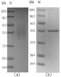 (Tris-Glycine gel) Discontinuous SDS-PAGE (reduced) with 5% enrichment gel and 15% separation gel. (Tris-Glycine gel) Discontinuous SDS-PAGE (reduced) with 5% enrichment gel and 15% separation gel.