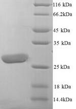 SDS-PAGE- Recombinant protein Human LILRA5