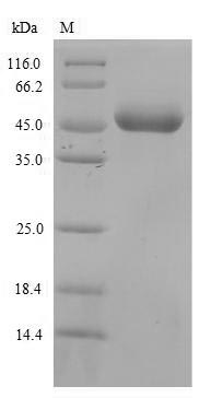 (Tris-Glycine gel) Discontinuous SDS-PAGE (reduced) with 5% enrichment gel and 15% separation gel. (Tris-Glycine gel) Discontinuous SDS-PAGE (reduced) with 5% enrichment gel and 15% separation gel.