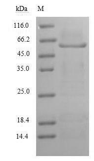 (Tris-Glycine gel) Discontinuous SDS-PAGE (reduced) with 5% enrichment gel and 15% separation gel. (Tris-Glycine gel) Discontinuous SDS-PAGE (reduced) with 5% enrichment gel and 15% separation gel.