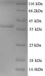 (Tris-Glycine gel) Discontinuous SDS-PAGE (reduced) with 5% enrichment gel and 15% separation gel. (Tris-Glycine gel) Discontinuous SDS-PAGE (reduced) with 5% enrichment gel and 15% separation gel.