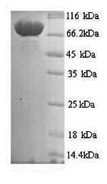 (Tris-Glycine gel) Discontinuous SDS-PAGE (reduced) with 5% enrichment gel and 15% separation gel. (Tris-Glycine gel) Discontinuous SDS-PAGE (reduced) with 5% enrichment gel and 15% separation gel.