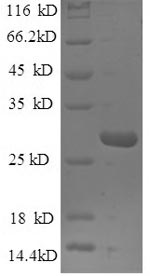 (Tris-Glycine gel) Discontinuous SDS-PAGE (reduced) with 5% enrichment gel and 15% separation gel. (Tris-Glycine gel) Discontinuous SDS-PAGE (reduced) with 5% enrichment gel and 15% separation gel.