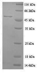 (Tris-Glycine gel) Discontinuous SDS-PAGE (reduced) with 5% enrichment gel and 15% separation gel. (Tris-Glycine gel) Discontinuous SDS-PAGE (reduced) with 5% enrichment gel and 15% separation gel.