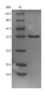 (Tris-Glycine gel) Discontinuous SDS-PAGE (reduced) with 5% enrichment gel and 15% separation gel. (Tris-Glycine gel) Discontinuous SDS-PAGE (reduced) with 5% enrichment gel and 15% separation gel.