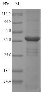 (Tris-Glycine gel) Discontinuous SDS-PAGE (reduced) with 5% enrichment gel and 15% separation gel. (Tris-Glycine gel) Discontinuous SDS-PAGE (reduced) with 5% enrichment gel and 15% separation gel.