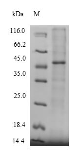(Tris-Glycine gel) Discontinuous SDS-PAGE (reduced) with 5% enrichment gel and 15% separation gel. (Tris-Glycine gel) Discontinuous SDS-PAGE (reduced) with 5% enrichment gel and 15% separation gel.