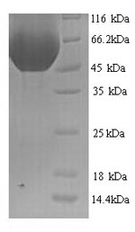 (Tris-Glycine gel) Discontinuous SDS-PAGE (reduced) with 5% enrichment gel and 15% separation gel. (Tris-Glycine gel) Discontinuous SDS-PAGE (reduced) with 5% enrichment gel and 15% separation gel.