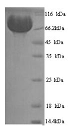 (Tris-Glycine gel) Discontinuous SDS-PAGE (reduced) with 5% enrichment gel and 15% separation gel. (Tris-Glycine gel) Discontinuous SDS-PAGE (reduced) with 5% enrichment gel and 15% separation gel.