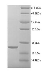 (Tris-Glycine gel) Discontinuous SDS-PAGE (reduced) with 5% enrichment gel and 15% separation gel. (Tris-Glycine gel) Discontinuous SDS-PAGE (reduced) with 5% enrichment gel and 15% separation gel.