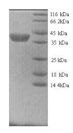 (Tris-Glycine gel) Discontinuous SDS-PAGE (reduced) with 5% enrichment gel and 15% separation gel. (Tris-Glycine gel) Discontinuous SDS-PAGE (reduced) with 5% enrichment gel and 15% separation gel.