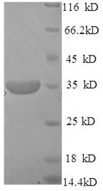 (Tris-Glycine gel) Discontinuous SDS-PAGE (reduced) with 5% enrichment gel and 15% separation gel. (Tris-Glycine gel) Discontinuous SDS-PAGE (reduced) with 5% enrichment gel and 15% separation gel.