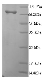 (Tris-Glycine gel) Discontinuous SDS-PAGE (reduced) with 5% enrichment gel and 15% separation gel. (Tris-Glycine gel) Discontinuous SDS-PAGE (reduced) with 5% enrichment gel and 15% separation gel.