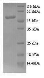 CSB-YP015278HU SDS-PAGE