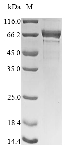 CSB-YP015535HU SDS-PAGE