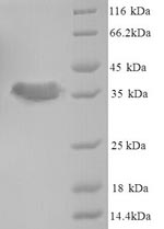 (Tris-Glycine gel) Discontinuous SDS-PAGE (reduced) with 5% enrichment gel and 15% separation gel. (Tris-Glycine gel) Discontinuous SDS-PAGE (reduced) with 5% enrichment gel and 15% separation gel.