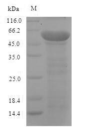 (Tris-Glycine gel) Discontinuous SDS-PAGE (reduced) with 5% enrichment gel and 15% separation gel. (Tris-Glycine gel) Discontinuous SDS-PAGE (reduced) with 5% enrichment gel and 15% separation gel.