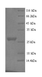 (Tris-Glycine gel) Discontinuous SDS-PAGE (reduced) with 5% enrichment gel and 15% separation gel. (Tris-Glycine gel) Discontinuous SDS-PAGE (reduced) with 5% enrichment gel and 15% separation gel.