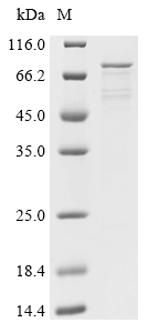 (Tris-Glycine gel) Discontinuous SDS-PAGE (reduced) with 5% enrichment gel and 15% separation gel. (Tris-Glycine gel) Discontinuous SDS-PAGE (reduced) with 5% enrichment gel and 15% separation gel.