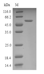 (Tris-Glycine gel) Discontinuous SDS-PAGE (reduced) with 5% enrichment gel and 15% separation gel. (Tris-Glycine gel) Discontinuous SDS-PAGE (reduced) with 5% enrichment gel and 15% separation gel.