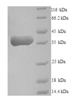 (Tris-Glycine gel) Discontinuous SDS-PAGE (reduced) with 5% enrichment gel and 15% separation gel. (Tris-Glycine gel) Discontinuous SDS-PAGE (reduced) with 5% enrichment gel and 15% separation gel.