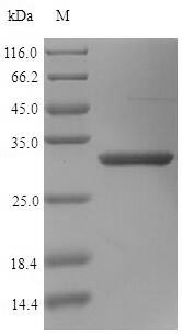 (Tris-Glycine gel) Discontinuous SDS-PAGE (reduced) with 5% enrichment gel and 15% separation gel. (Tris-Glycine gel) Discontinuous SDS-PAGE (reduced) with 5% enrichment gel and 15% separation gel.