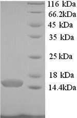 (Tris-Glycine gel) Discontinuous SDS-PAGE (reduced) with 5% enrichment gel and 15% separation gel. (Tris-Glycine gel) Discontinuous SDS-PAGE (reduced) with 5% enrichment gel and 15% separation gel.