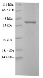 (Tris-Glycine gel) Discontinuous SDS-PAGE (reduced) with 5% enrichment gel and 15% separation gel. (Tris-Glycine gel) Discontinuous SDS-PAGE (reduced) with 5% enrichment gel and 15% separation gel.