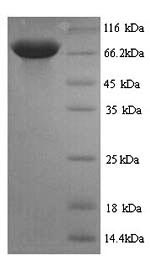(Tris-Glycine gel) Discontinuous SDS-PAGE (reduced) with 5% enrichment gel and 15% separation gel. (Tris-Glycine gel) Discontinuous SDS-PAGE (reduced) with 5% enrichment gel and 15% separation gel.